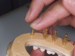 Система JetFix