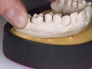 Система JetFix