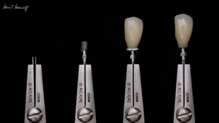 Держатель Smile Line для индивидуальных гибридных склеиваемых абатментов