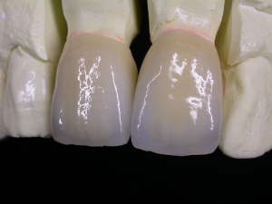 Путь к профессиональному дентальному фотo. Томас Хеннингер. Часть I