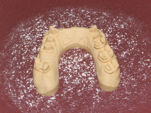 Система JetPin