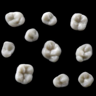 N-ARCHITECT WAX-UP ASSISTANT POSTERIOR