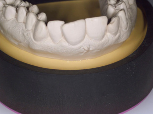 Система JetFix