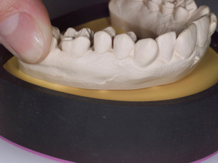 Система JetFix