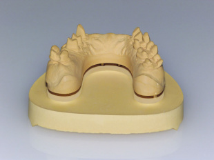 Система JetPin