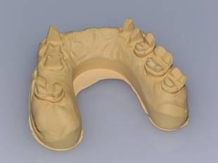 Система JetPin