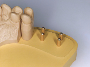 Система JetFix