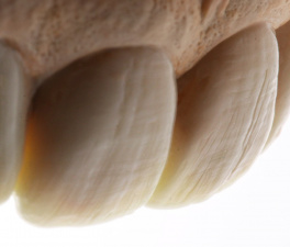 Слоган этого инструмента: «Неповторимая вторичная анатомия зуба»