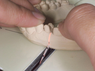 Система JetFix