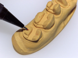 Система JetPin