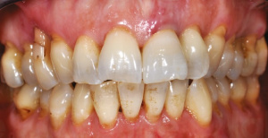 "Масса" индивидуализации