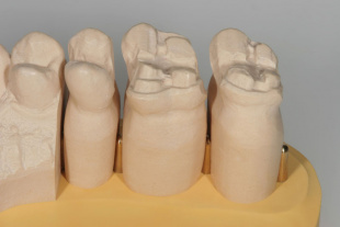 Система JetPin