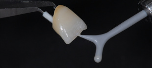 Микровибратор Smile Line Micro-Vibes 2