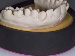 Система JetFix