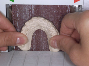 Система JetFix