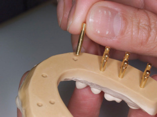 Система JetFix