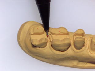 Система JetPin