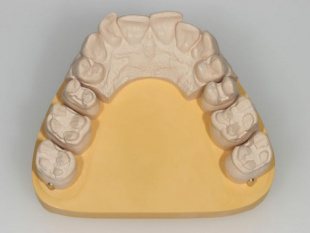 Система JetPin