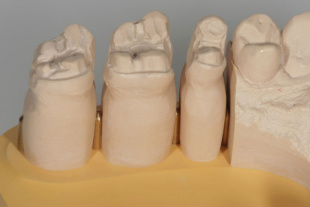 Система JetPin