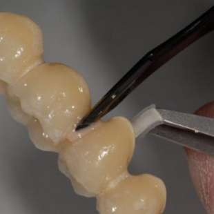 Микровибратор Smile Line Micro-Vibes