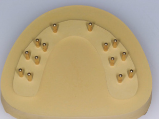 Система JetFix